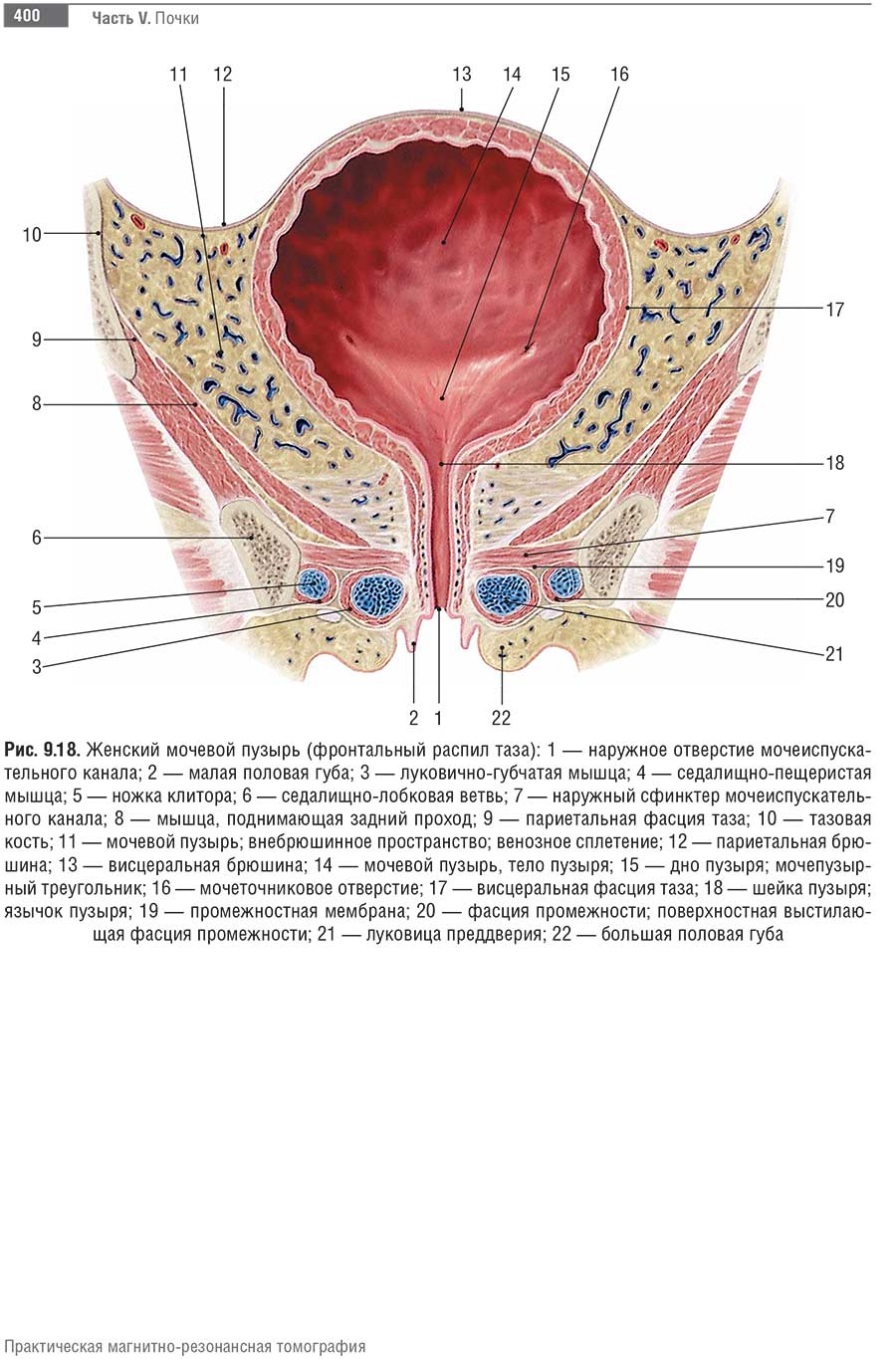 Женский мочевой пузырь (фронтальный распил таза)