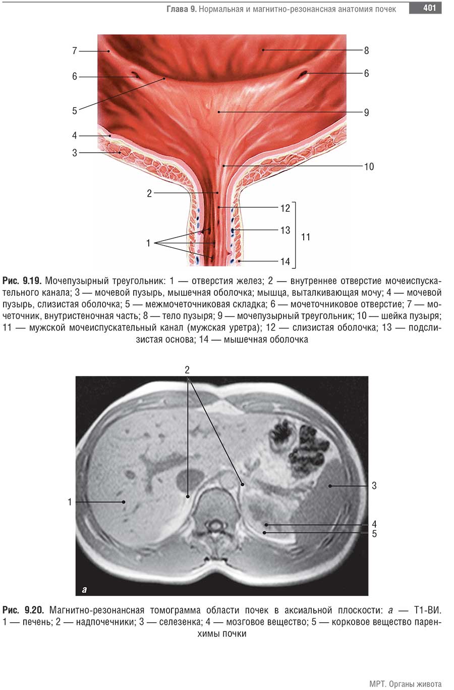 Магнитно-резонансная томограмма области почек в аксиальной плоскости