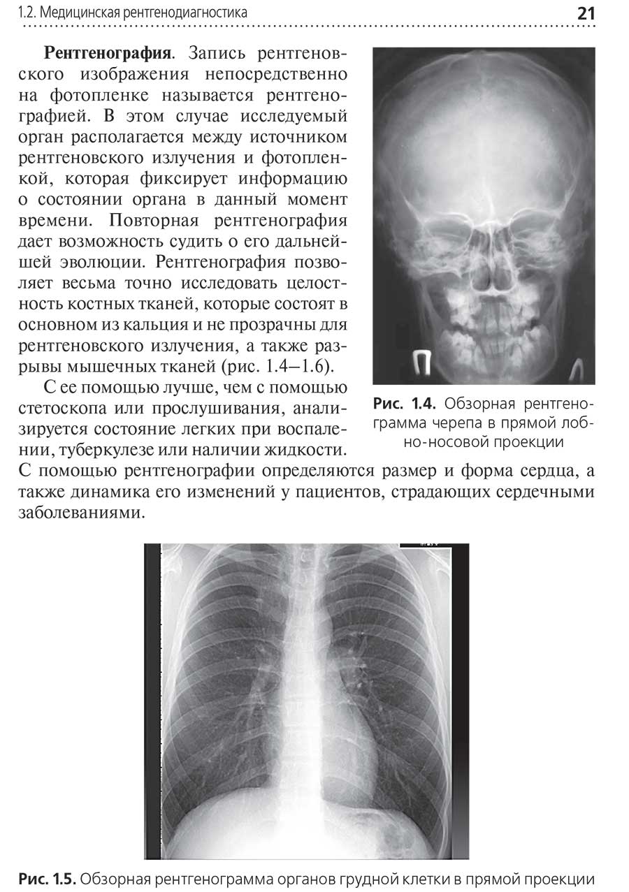 Рис. 1.5. Обзорная рентгенограмма органов грудной клетки в прямой проекции