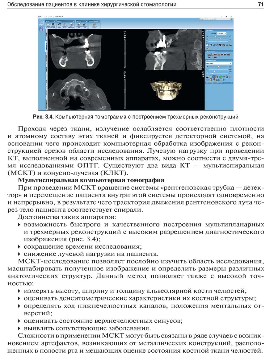 Рис. 3.4. Компьютерная томограмма с построением трехмерных реконструкций