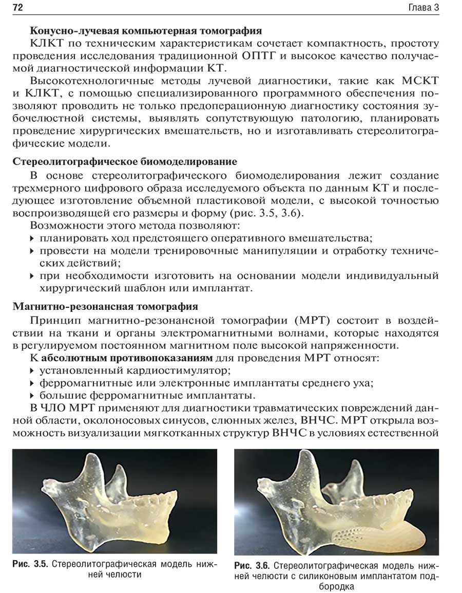 Рис. 3.5. Стереолитографическая модель нижней челюсти