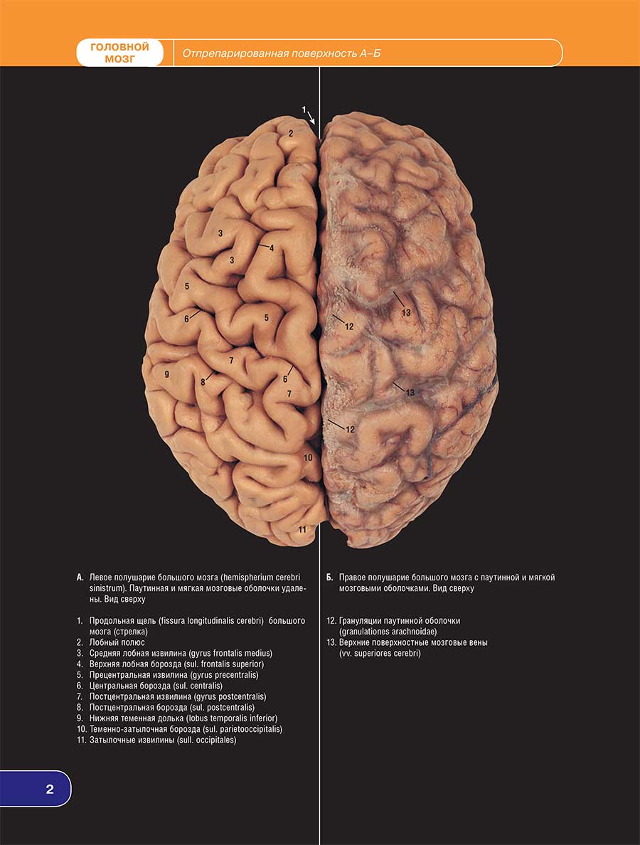Левое полушарие большого мозга (hemisphenum cerebri sinistrum). Паутинная и мягкая мозговые оболочки удалены. Вид сверху