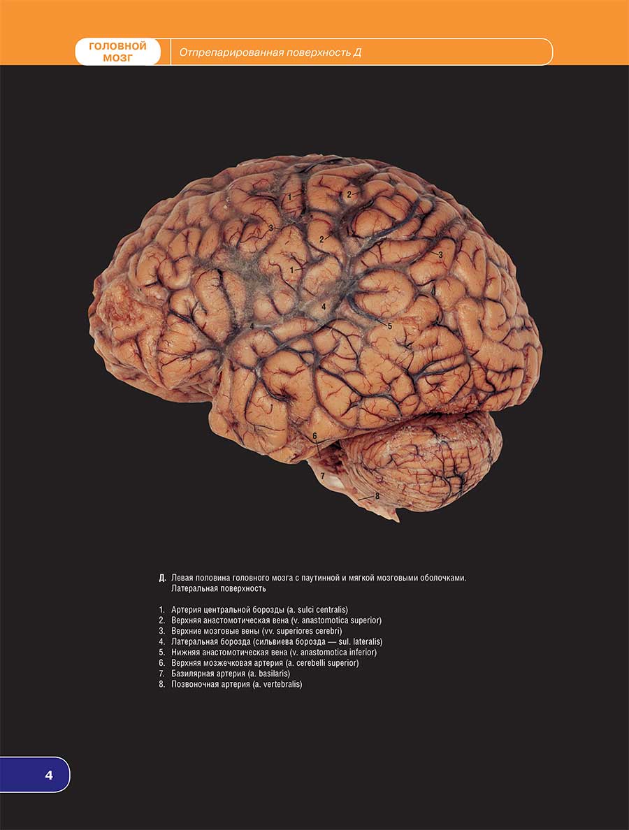 Д. Левая половина головного мозга с паутинной и мягкой мозговыми оболочками. Латеральная поверхность