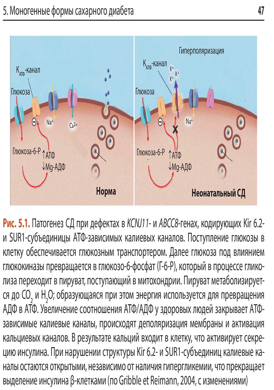 Рис. 5.1. Патогенез СД при дефектах в KCNJ11- и ABСС8-генах,