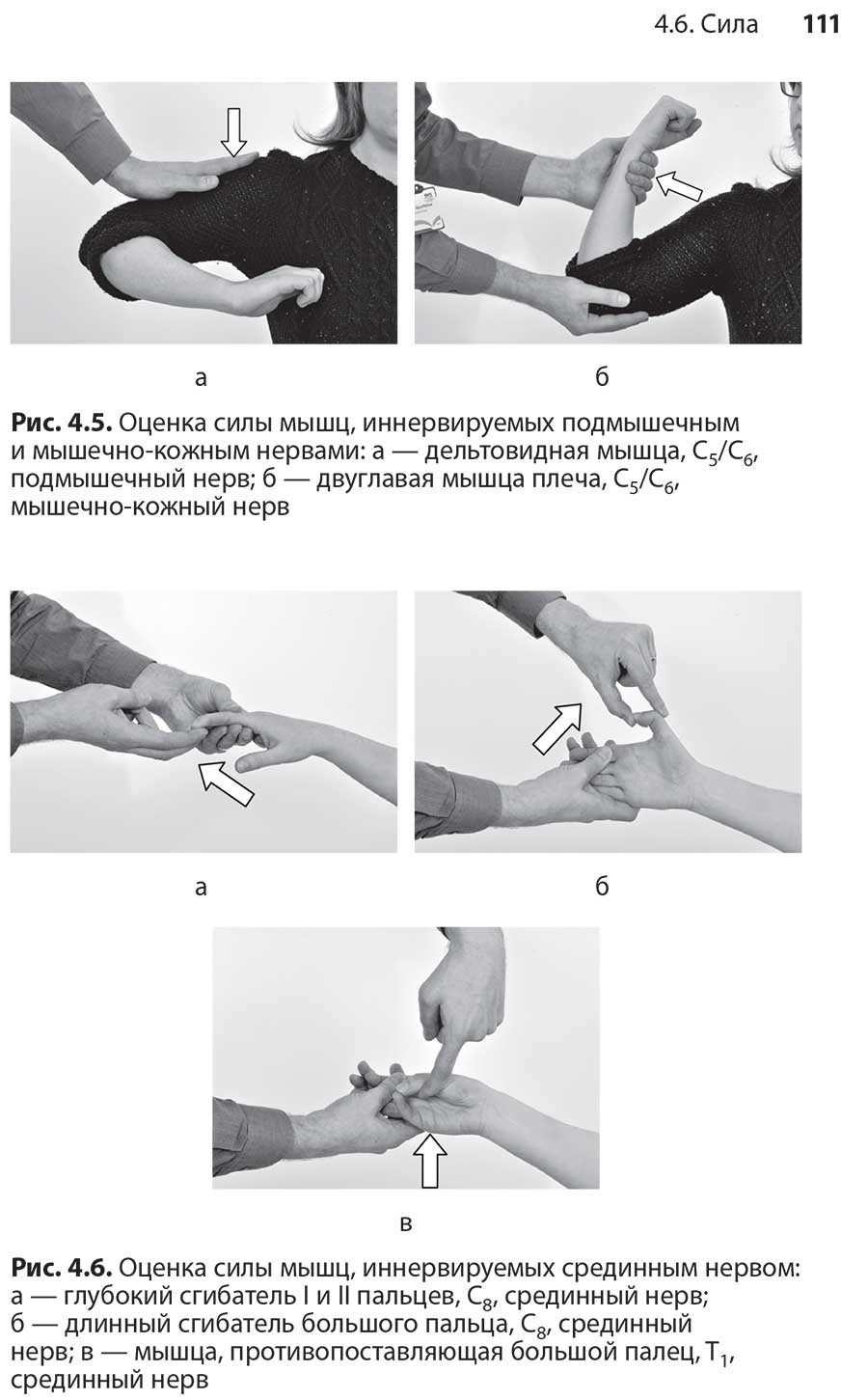 Рис. 4.6. Оценка силы мышц