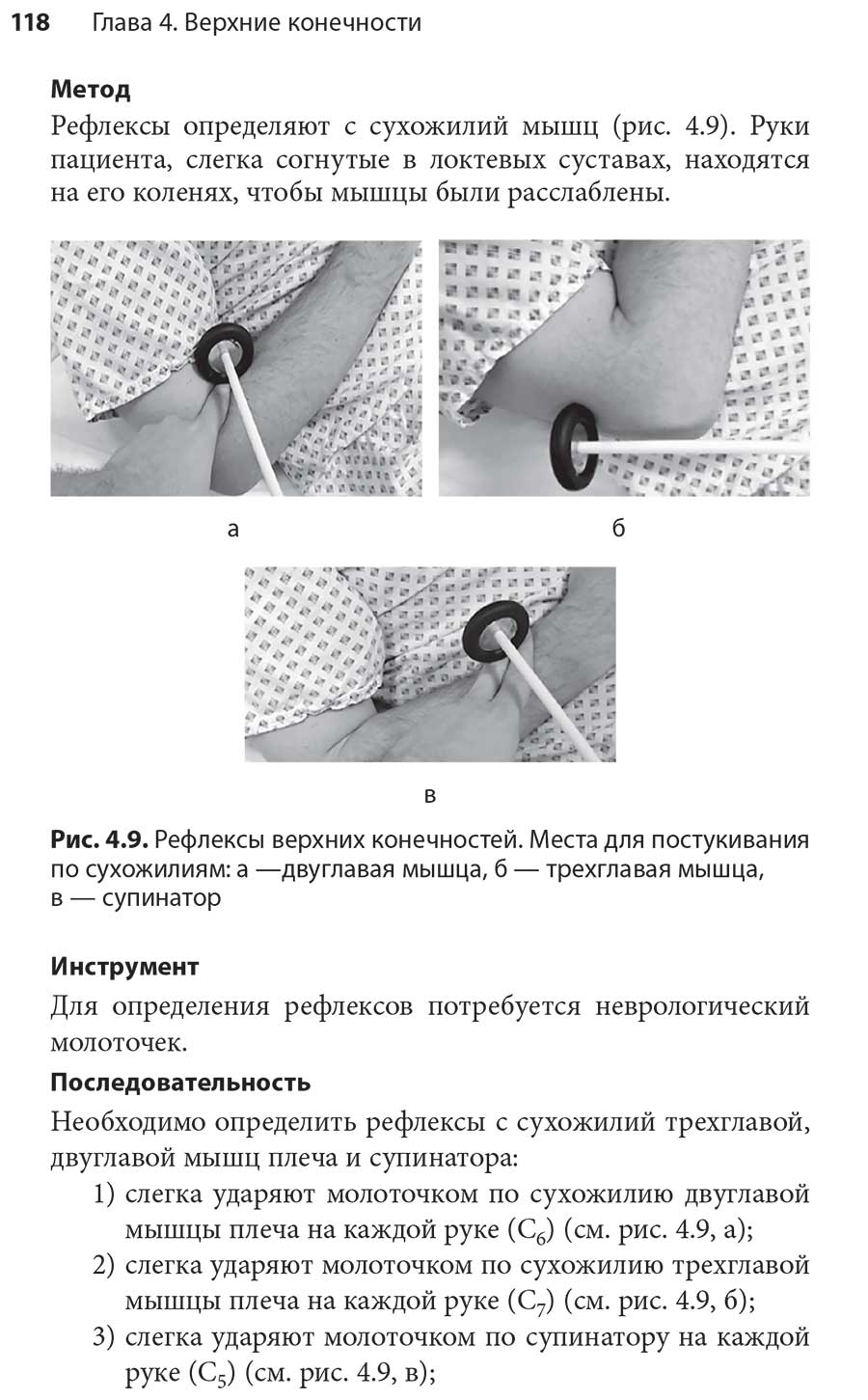 Рис. 4.9. Рефлексы верхних конечностей.