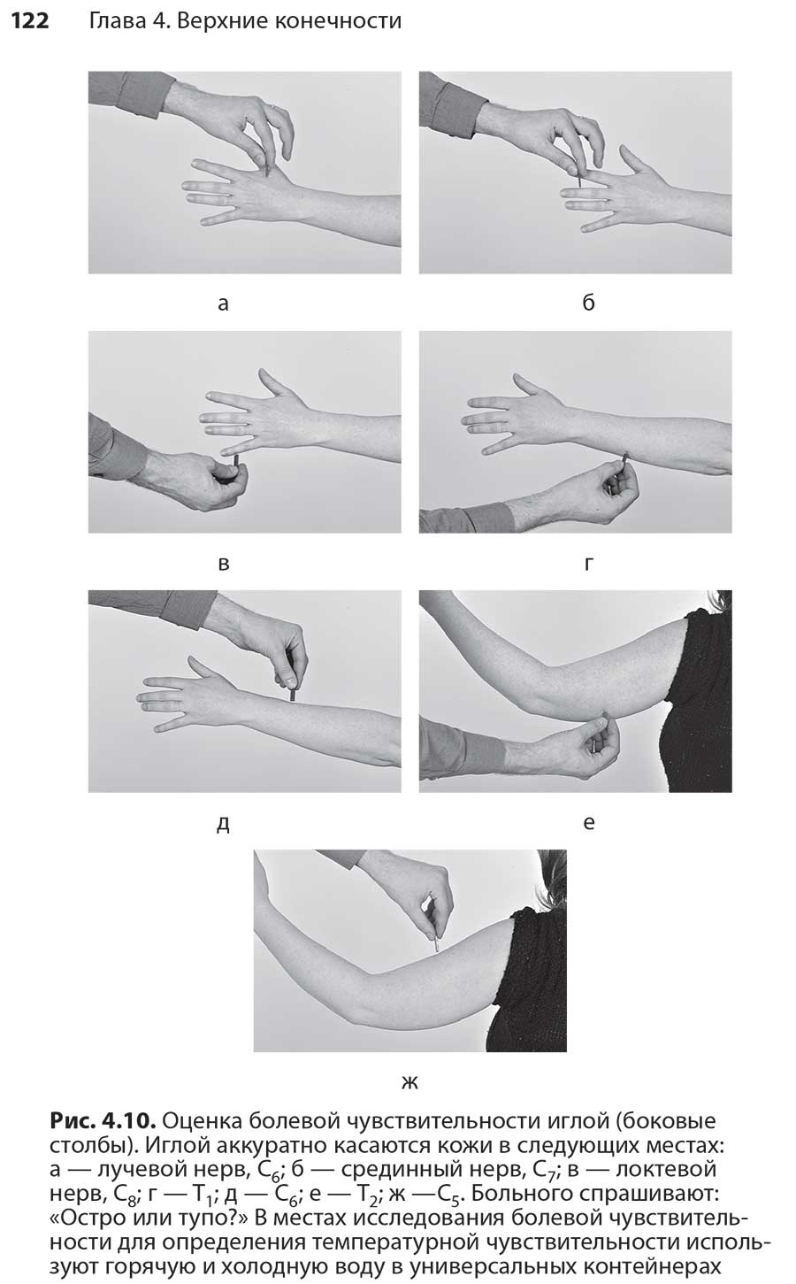 Рис. 4.10. Оценка болевой чувствительности иглой