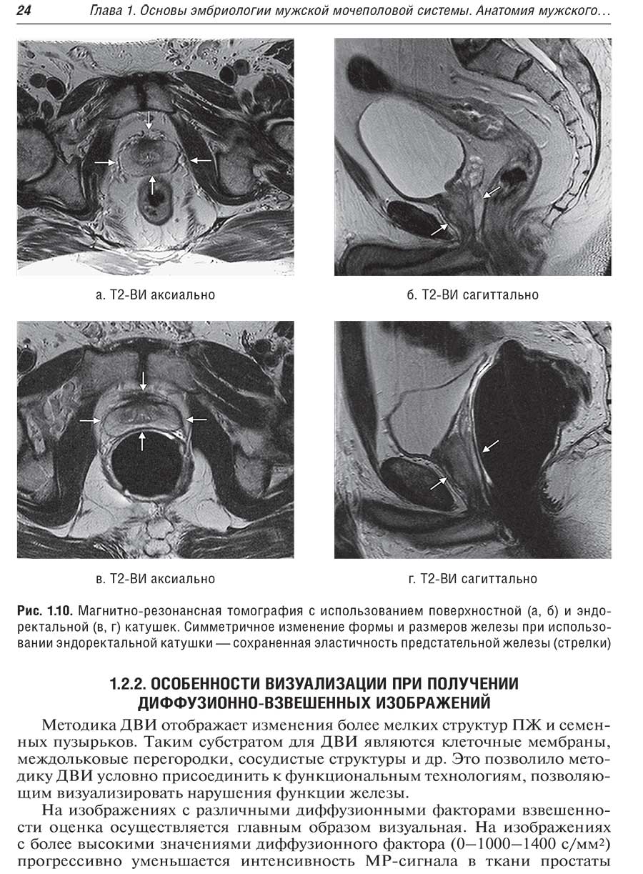 Рис. 1.10. Магнитно-резонансная томография с использованием поверхностной