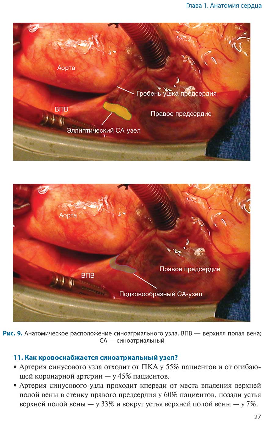 Рис. 9. Анатомическое расположение синоатриального узла