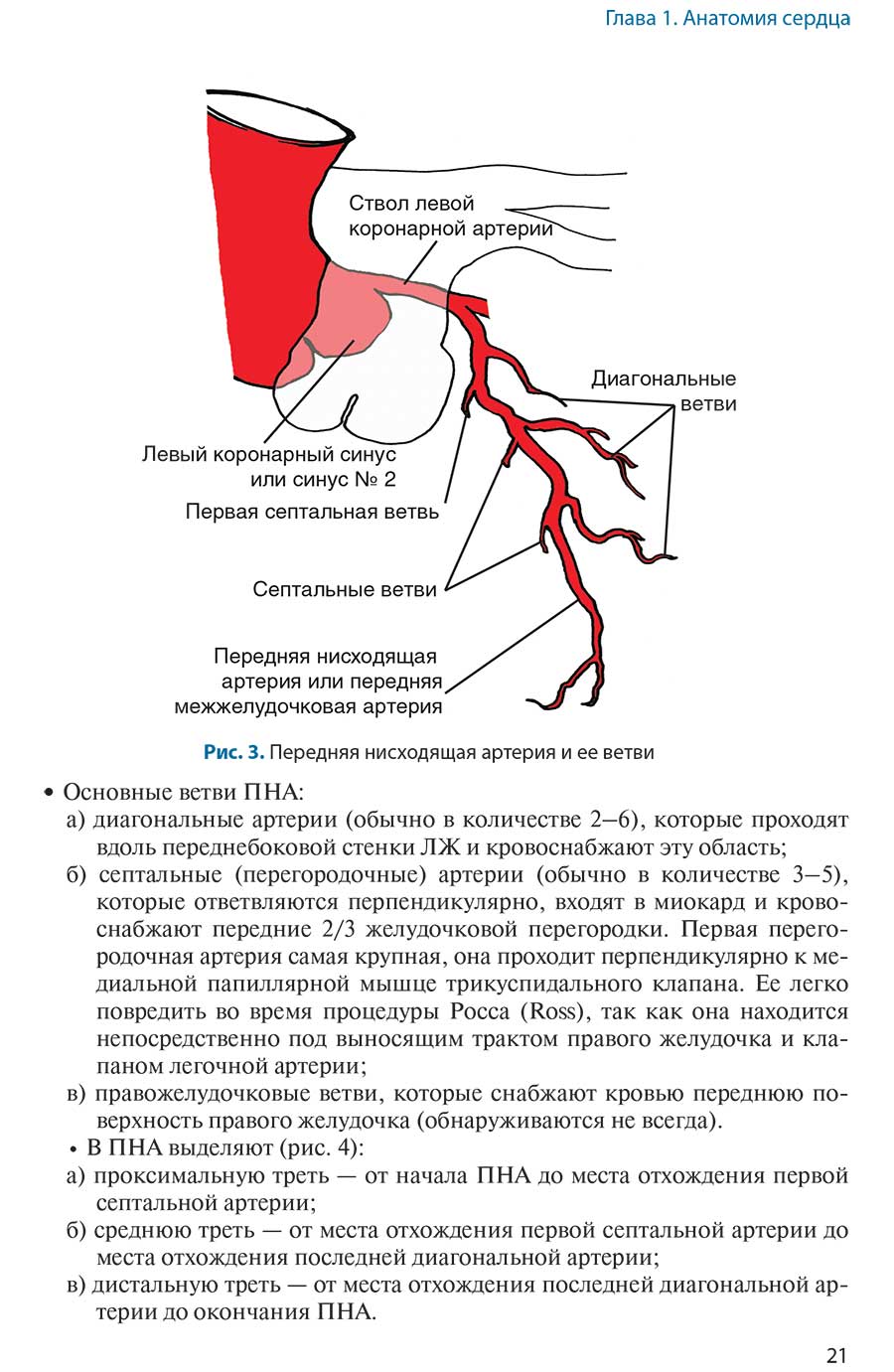 Рис. 3. Передняя нисходящая артерия и ее ветви