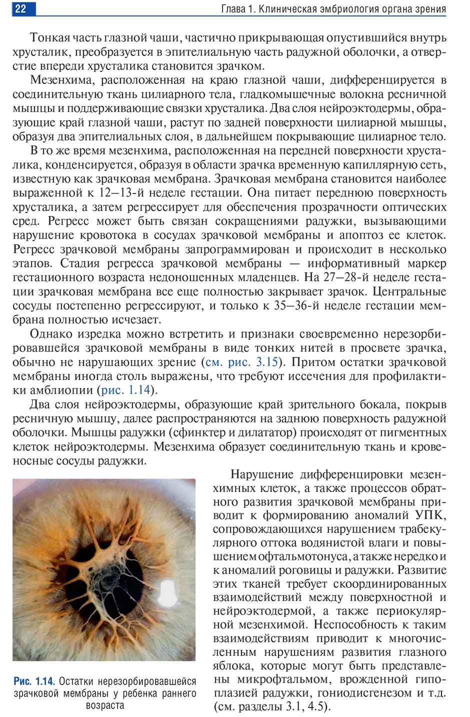 Пример страницы из книги  "Неонатальная офтальмология: руководство для врачей" - Бржеский В. В.