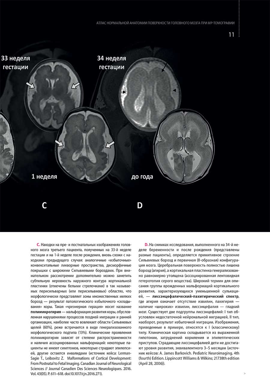 Пример страницы из книги "Атлас нормальной анатомии поверхности головного мозга при МР-томографии"