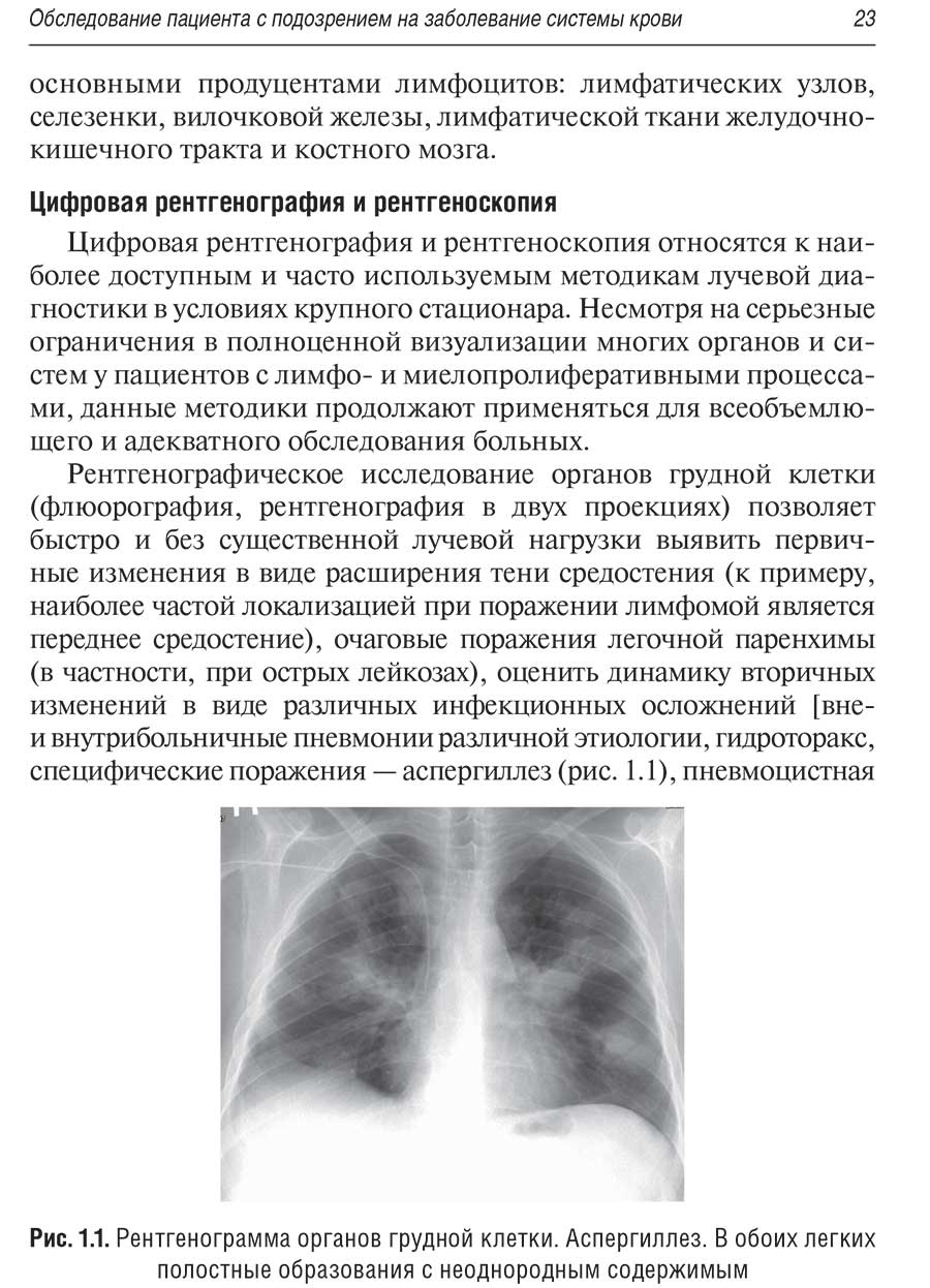 Рис. 1.1. Рентгенограмма органов грудной клетки.