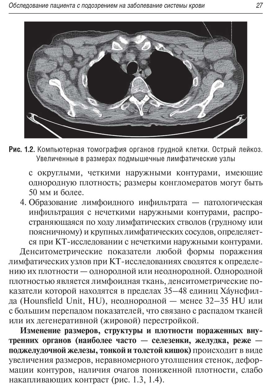 Рис. 1.2. Компьютерная томография органов грудной клетки.