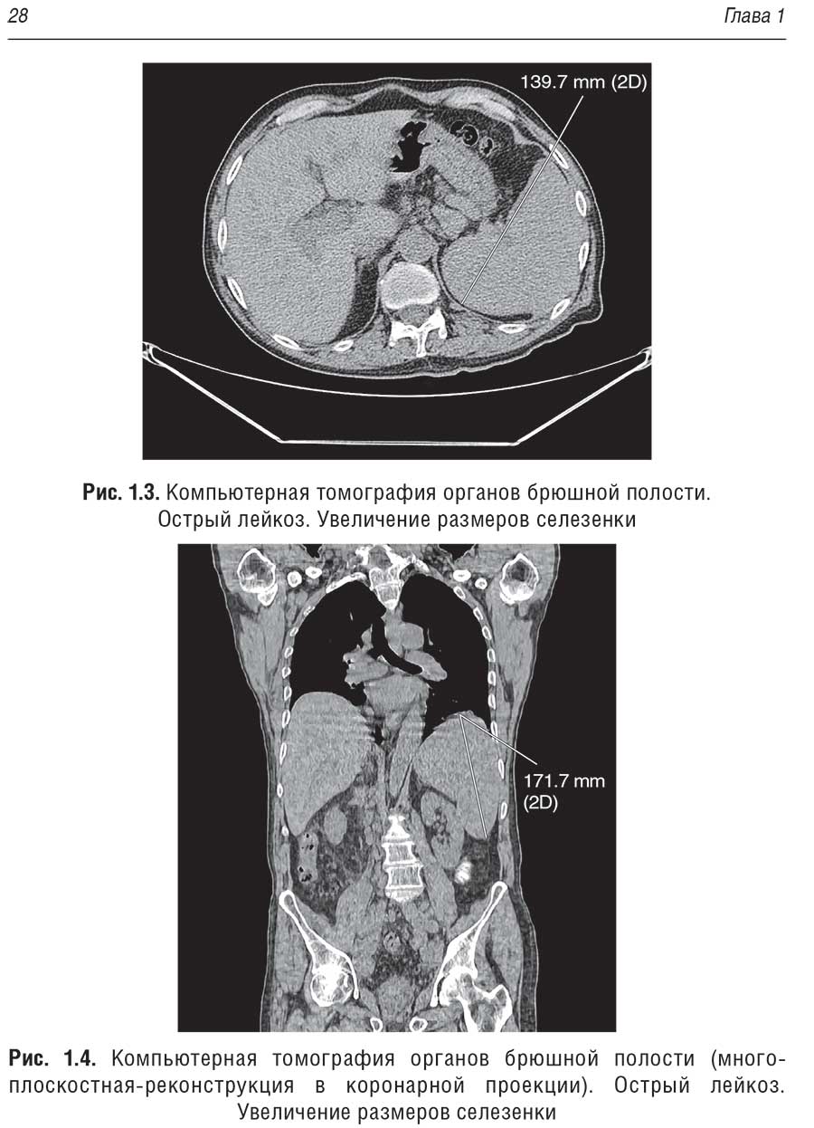 Рис. 1.3. Компьютерная томография органов брюшной полости.