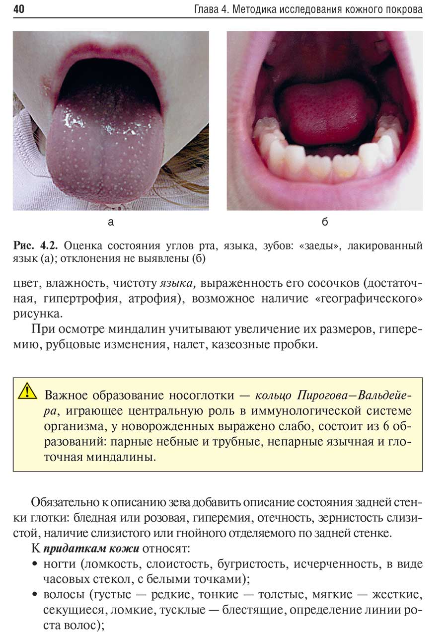 Рис. 4.2. Оценка состояния углов рта, языка, зубов: «заеды», лакированный язык (а); отклонения не выявлены (б)