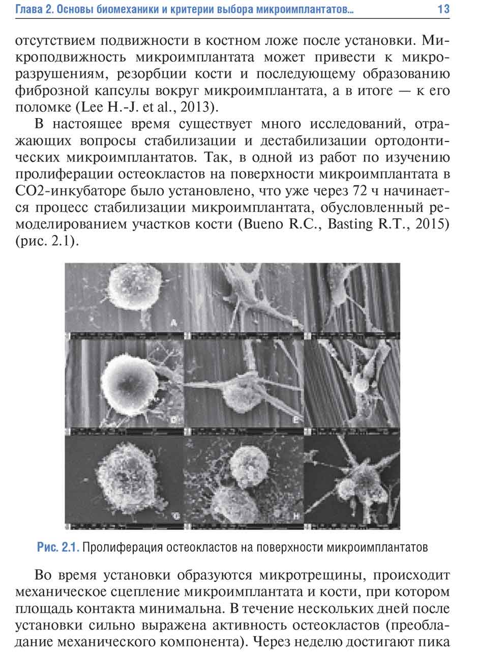 Рис. 2.1. Пролиферация остеокластов на поверхности микроимплантатов