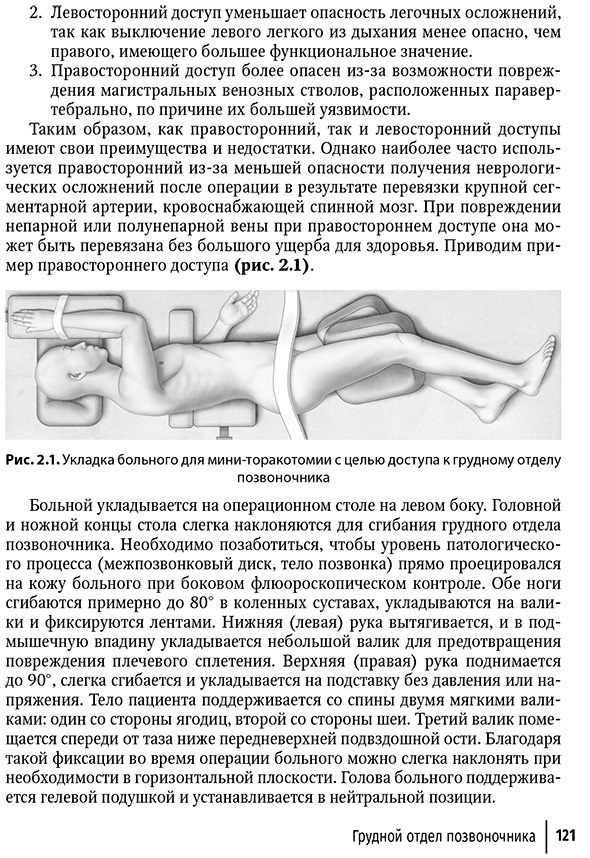 Укладка больного для мини-торакотомии с целью доступа к грудному отделу позвоночника Укладка больного для мини-торакотомии с целью доступа к грудному отделу позвоночника