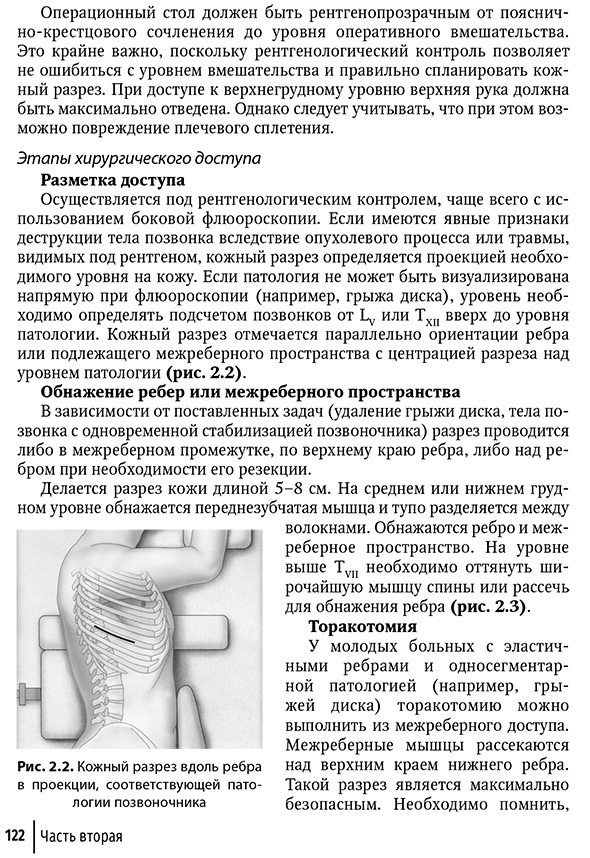 Кожный разрез вдоль ребра в проекции, соответствующей патологии позвоночника Кожный разрез вдоль ребра в проекции, соответствующей патологии позвоночника