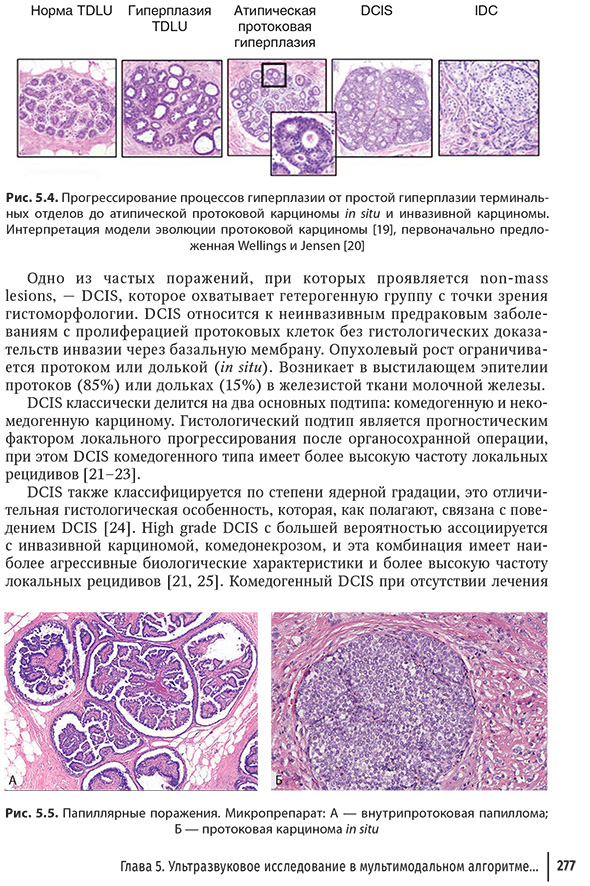 Папиллярные поражения.