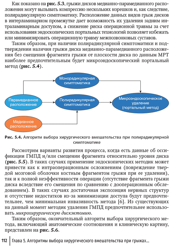 Алгоритм выбора хирургического вмешательства при полирадикулярной симптоматике