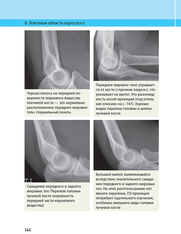 Локтевая область взрослого