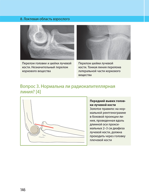 Нормальна ли радиокапителлярная