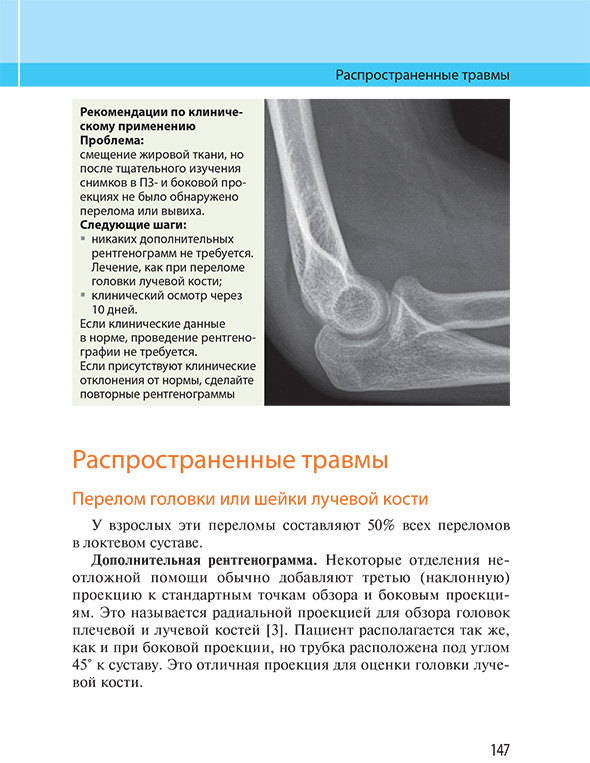 Распространенные травмы