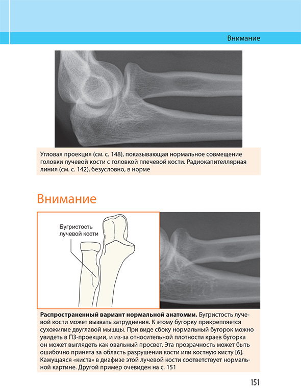 Распространенный вариант нормальной анатомии.