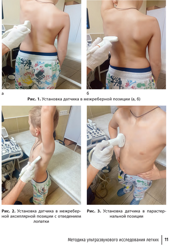 Установка датчика в межреберной позиции