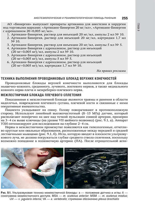 Ультразвуковая техника межлестничной блокады