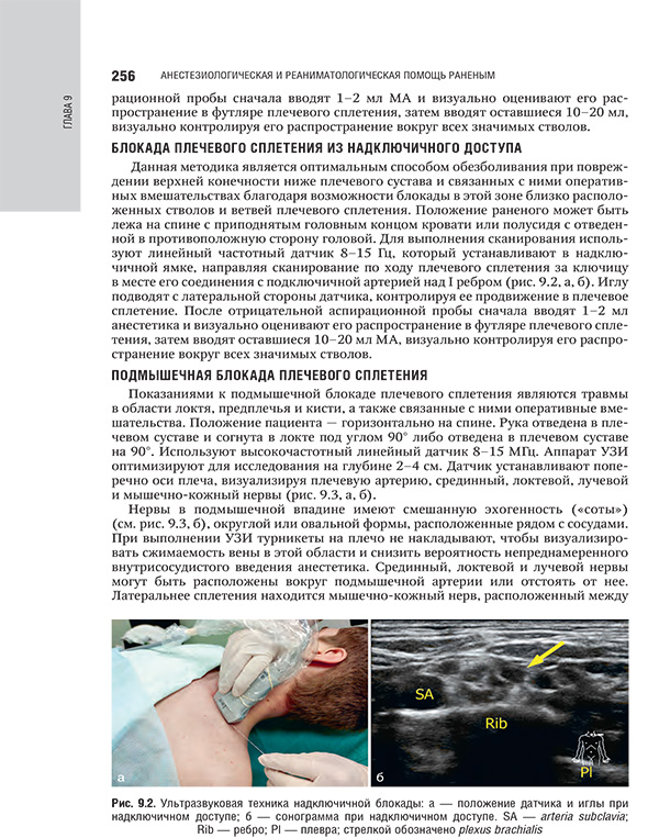 Ультразвуковая техника надключичной блокады