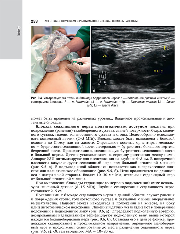 Ультразвуковая техника блокады бедренного нерва