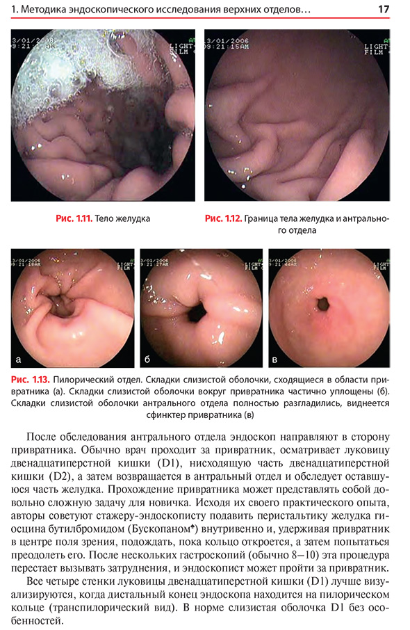 Пилорический отдел