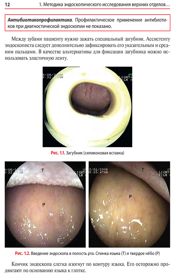 Введение эндоскопа в полость рта.