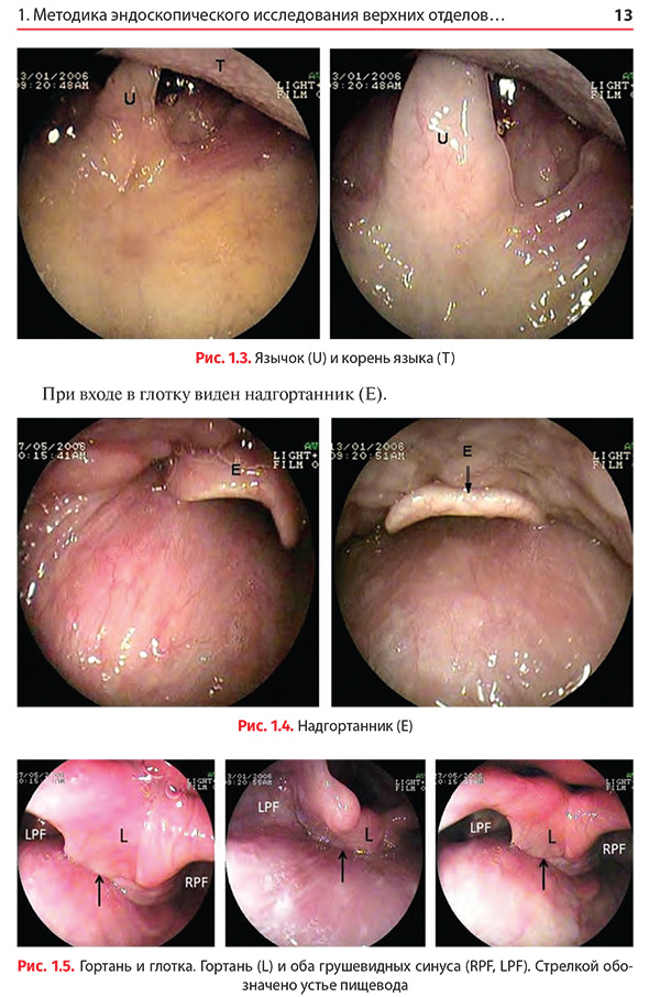 Гортань и глотка. Гортань