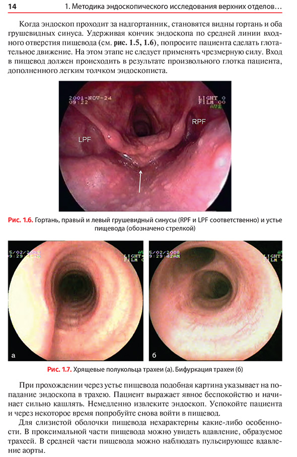 Хрящевые полукольца трахеи