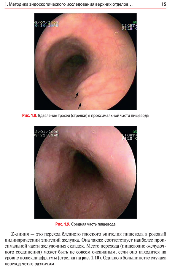 Средняя часть пищевода