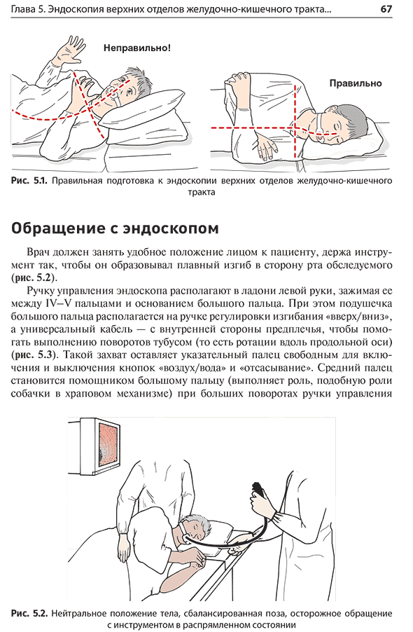 Правильная подготовка к эндоскопии верхних отделов желудочно-кишечного тракта