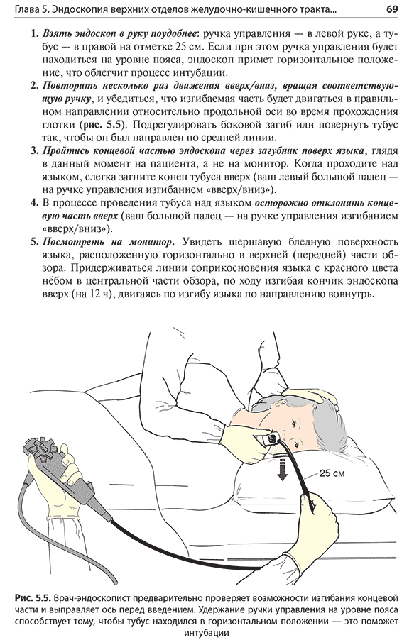 Рис. 5.5. Врач-эндоскопист предварительно проверяет возможности изгибания концевой части и выправляет ось перед введением