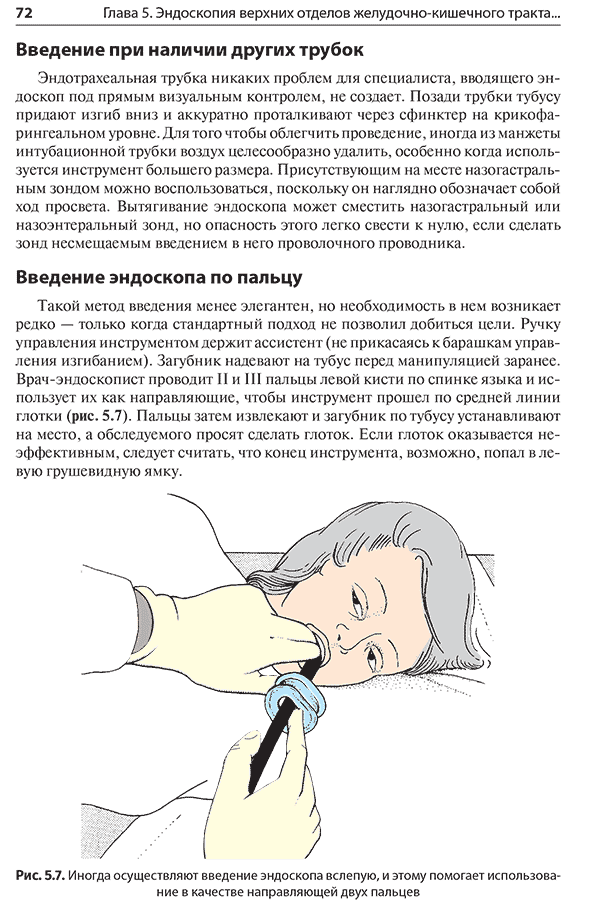 Иногда осуществляют введение эндоскопа вслепую, и этому помогает использование в качестве направляющей двух пальцев