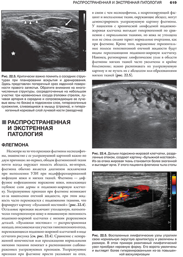 Рис. 22.3. Критически важно помнить о соседних структурах при планировании вскрытия и дренирования.