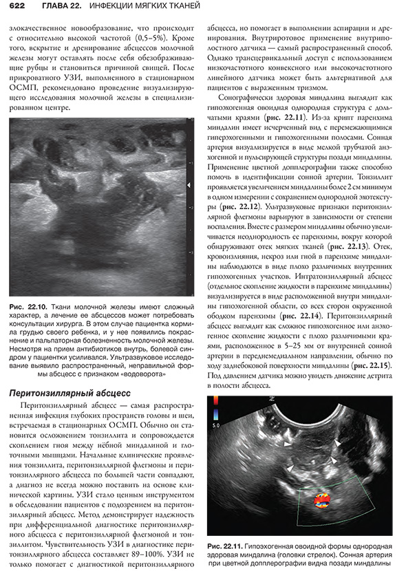 Рис. 22.10. Ткани моленной железы имеют сложный характер, а лечение ее абсцессов может потребовать консультации хирурга. 