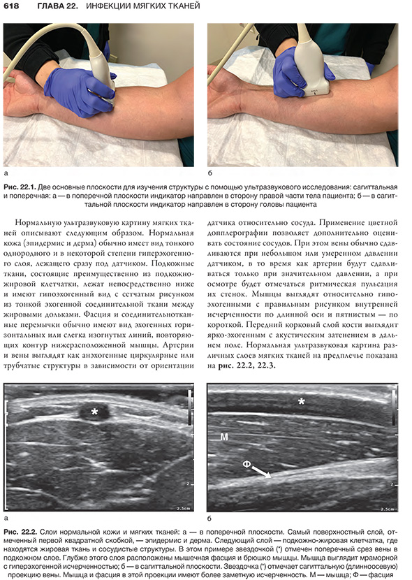 Две основные плоскости для изучения структуры с помощью ультразвукового исследования