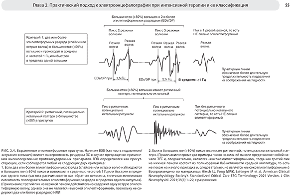 Выраженные эпилептиформные приступы. 