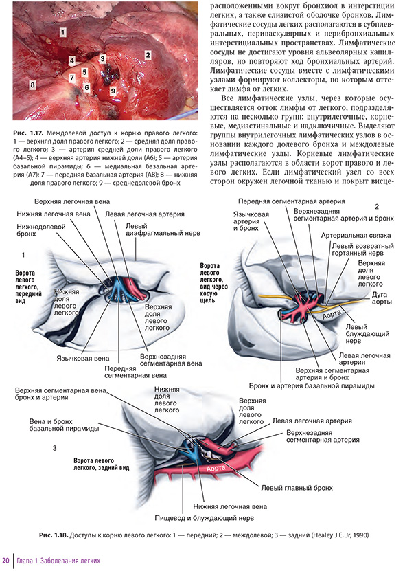 Доступы к корню левого легкого