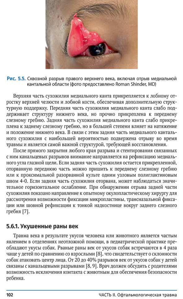 Сквозной разрыв правого верхнего века