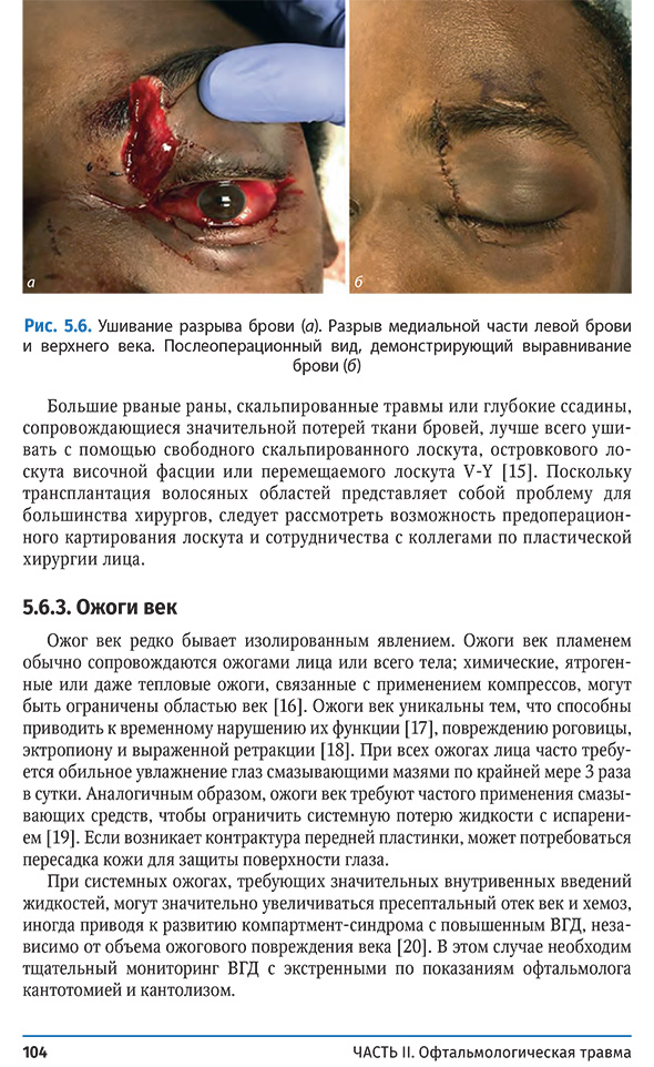 Ушивание разрыва брови