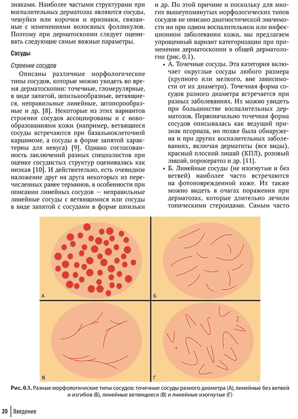 Равные морфологические типы сосудов: точечные сосуды разного диаметра