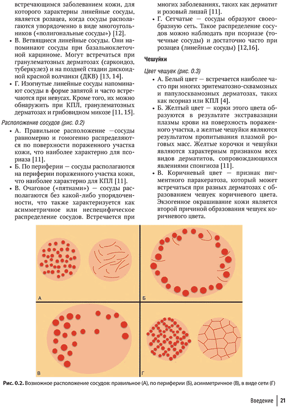 Возможное расположение сосудов: правильное (А), по периферии (Б), асимметричное (В), в виде сети (Г)